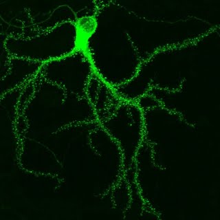 GFP-tagged protein in a hippocampal neuron. © Paul De Koninck
